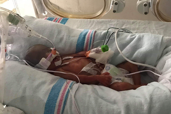 23 week old hot sale preemie